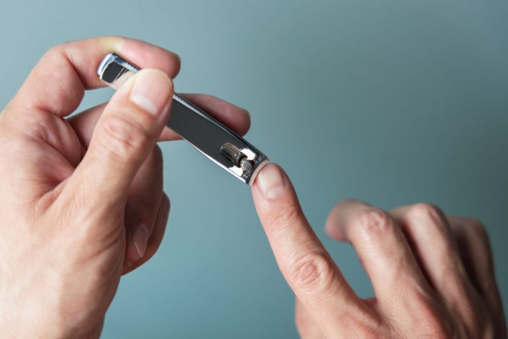 ongle artificiel chirurgie prix