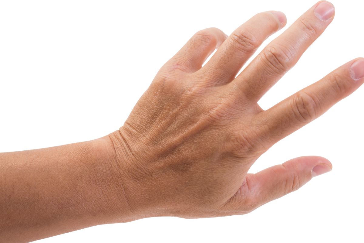 ongle artificiel chirurgie prix